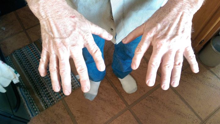 Six Fingers (3 pics)
