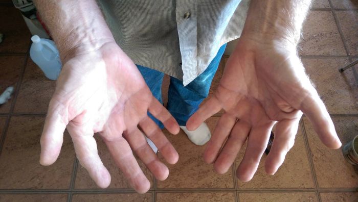 Six Fingers (3 pics)