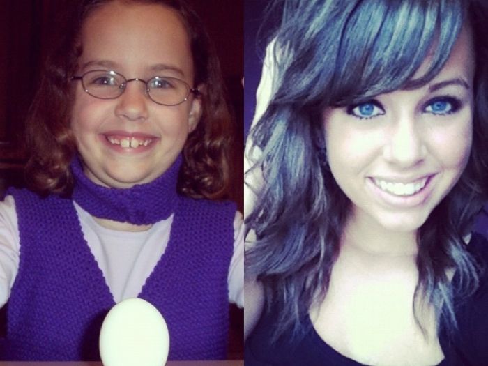 Ugly Ducklings Then And Now (24 pics)