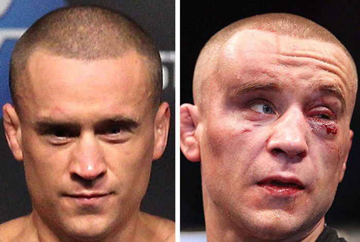 UFC Fighters Before And After A Fight (15 pics)