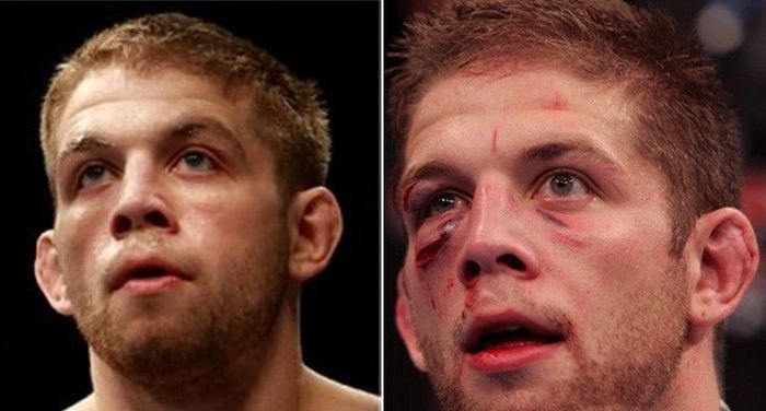 UFC Fighters Before And After A Fight (15 pics)