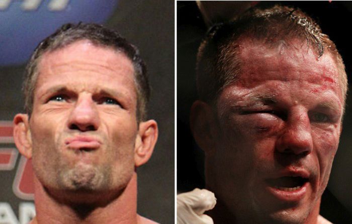 ufc-fighters-before-and-after-a-fight-15-pics