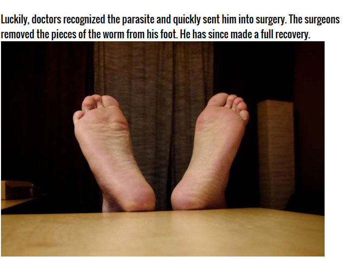 Man Thought He Had An Infected Foot But It Was Much Worse (4 pics)