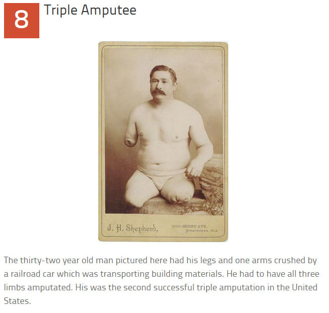 10 Disturbing Medical Images Throughout History (10 pics)