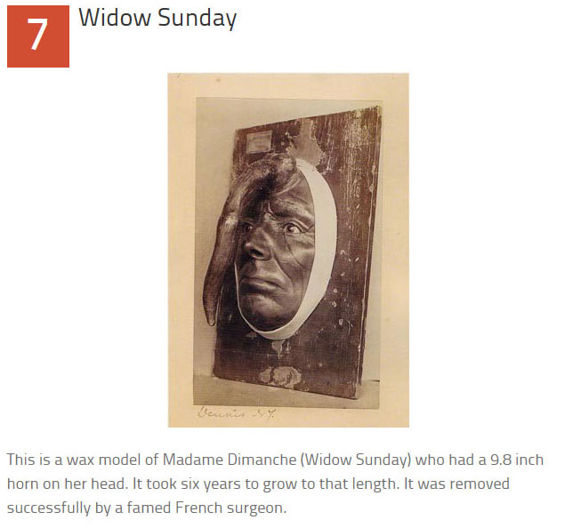 10 Disturbing Medical Images Throughout History (10 pics)