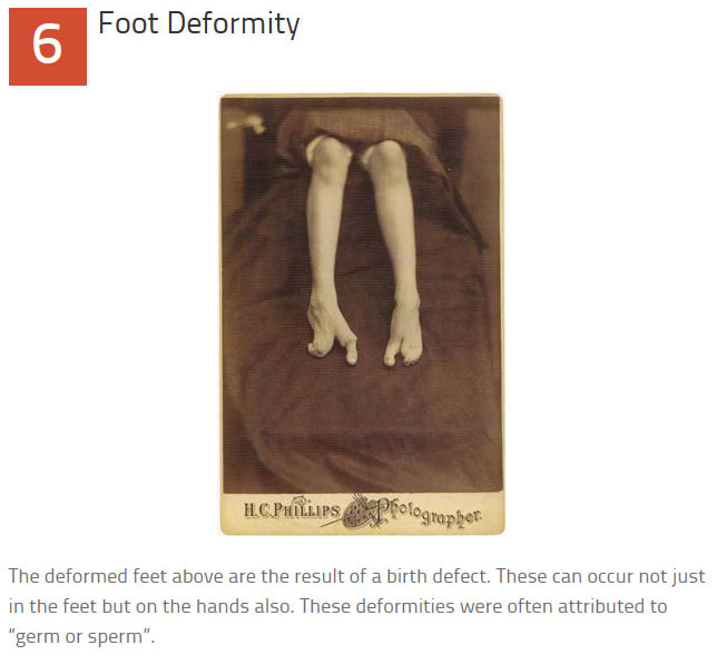 10 Disturbing Medical Images Throughout History (10 pics)