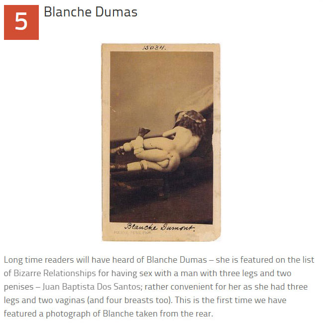 10 Disturbing Medical Images Throughout History (10 pics)