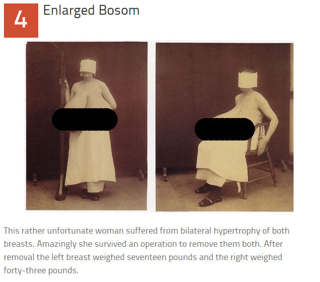 10 Disturbing Medical Images Throughout History (10 pics)