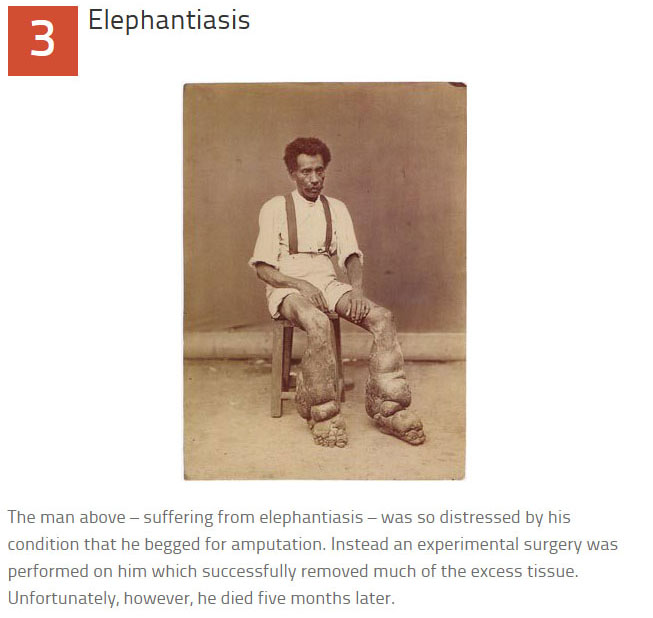 10 Disturbing Medical Images Throughout History (10 pics)