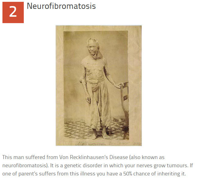 10 Disturbing Medical Images Throughout History (10 pics)