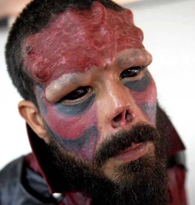 Comic Book Fan Chops Off His Nose So He Can Look Like The Red Skull (11 pics)