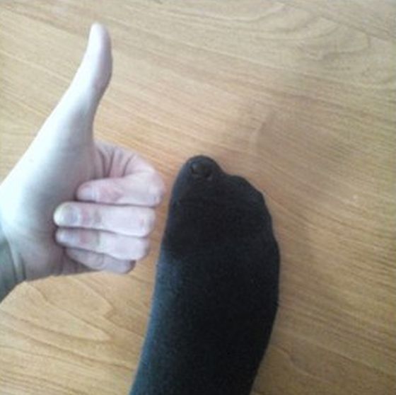 How To Fix A Torn Sock (3 pics)