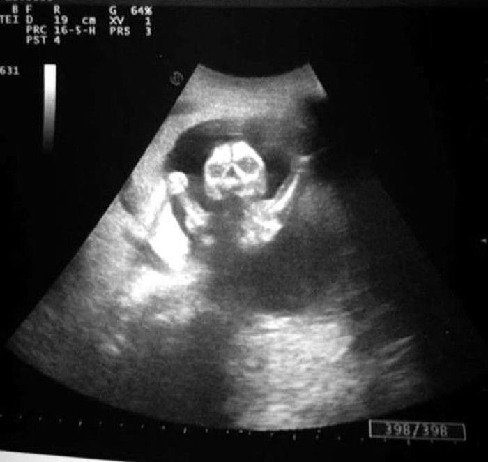 Ultrasounds That Look Like Nightmares Come To Life (13 pics)