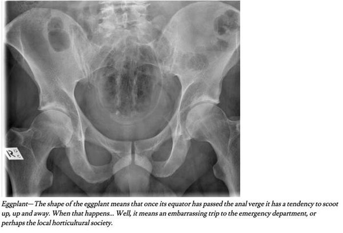 These X-Rays Show That People Put Some Strange Items In Their Butts (8 pics)