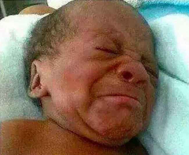 These Babies Just Look Like Really Small Old People (18 pics)