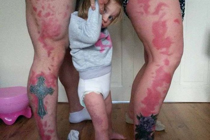These Parents Got Their Daughter's Giant Birthmark Tattooed On Them (4 pics)