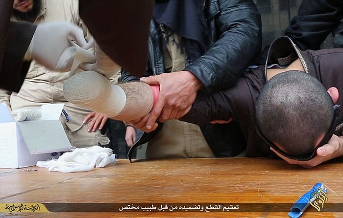 ISIS Amputates Hand Of A Motorbike Thief (8 pics)