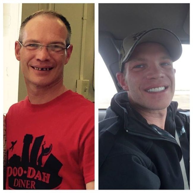 Wealthy Man Gives $25,000 Tip To Waiter So He Can Fix His Teeth (7 pics)