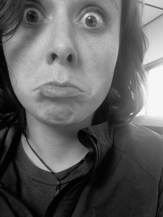 Woman's Freckles Disappear Thanks To Alaska (2 pics)