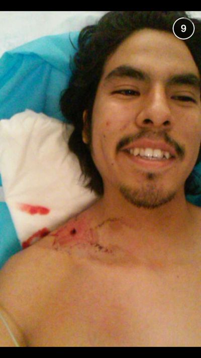 Guy Gets Shot And Just Laughs It Off (3 pics)