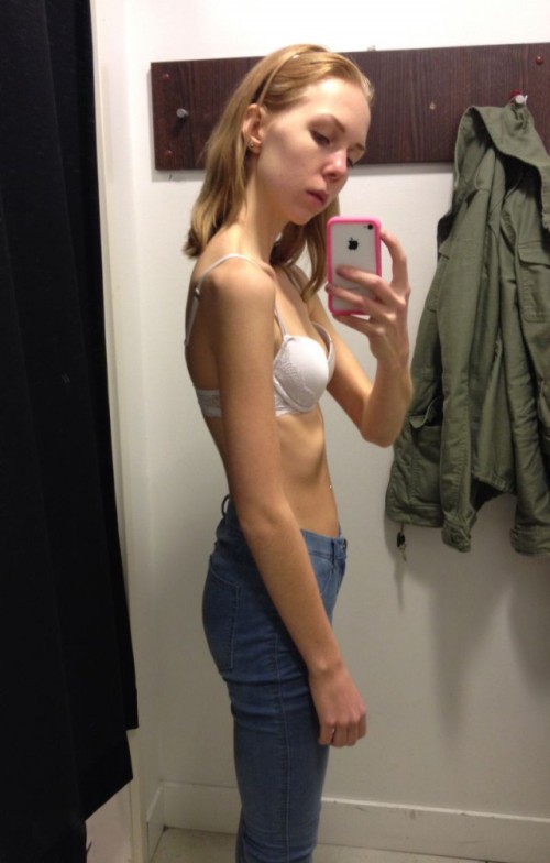 Exercise Is The Antidote For Anorexia (9 pics)