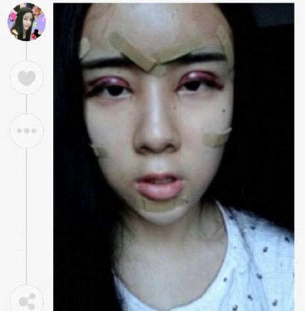 15 Year Old Girl Undergoes Controversial Plastic Surgery 11 Pics