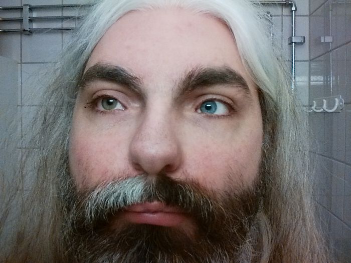 This Is What Complete Heterochromia Looks Like (2 pics)