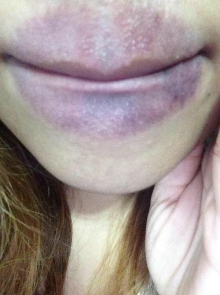 The Kylie Jenner Lip Challenge Has Turned Into A Complete Disaster (19 pics)