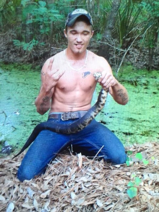 Florida Man Hospitalized After A Snake Bites His Face (9 pics)