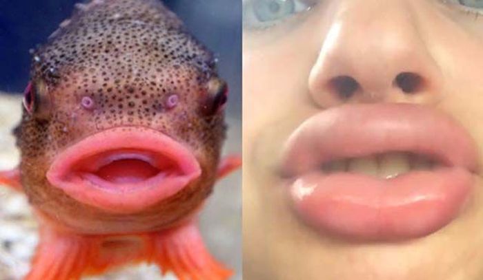 The Kylie Jenner Lip Challenge Continues To Give Girls Fish Lips (14 pics)