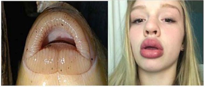 The Kylie Jenner Lip Challenge Continues To Give Girls Fish Lips (14 pics)