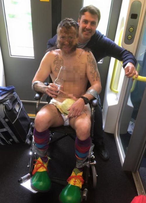 This Guy's Friends Glued Pubic Hair To His Face For His Bachelor Party (3 pics)