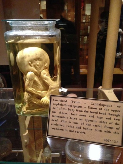 This Museum Is Like A Nightmare Come To Life (16 pics)
