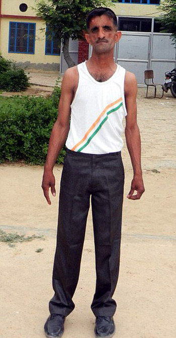 This Indian Man Holds A World Record Thanks To His Rubber Arms  (6 pics)