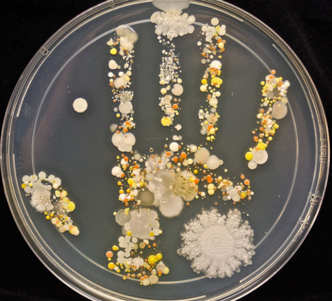 See What Was On This 8 Year Old Boy’s Handprint After Playing Outside (3 pics)