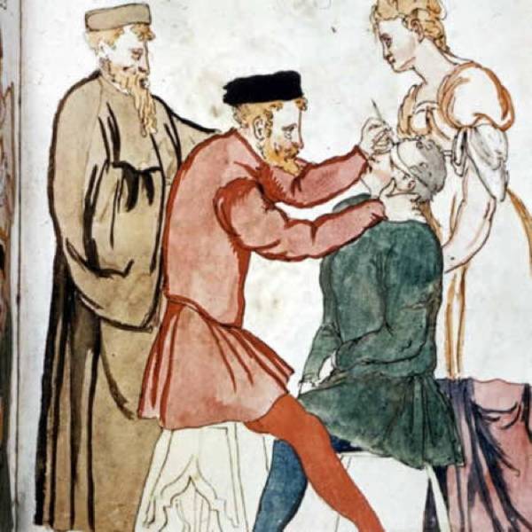 Bizarre Medical Devices That Were Used During Medieval Times (9 pics)