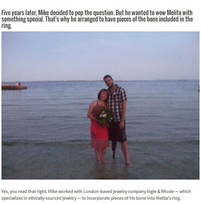 This Man Literally Put A Piece Of Himself Inside An Engagement Ring (7 pics)