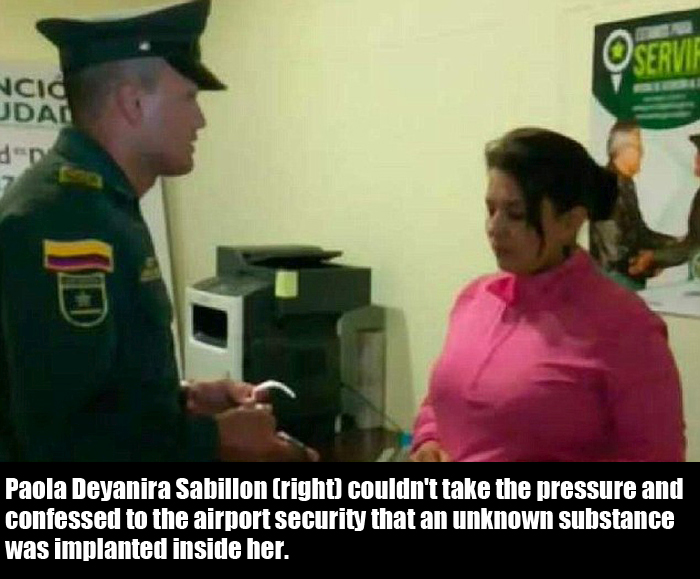 Woman Uses Her Breast Implants To Try And Smuggle Cocaine (5 pics)