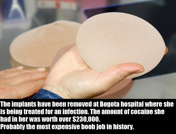 Woman Uses Her Breast Implants To Try And Smuggle Cocaine (5 pics)