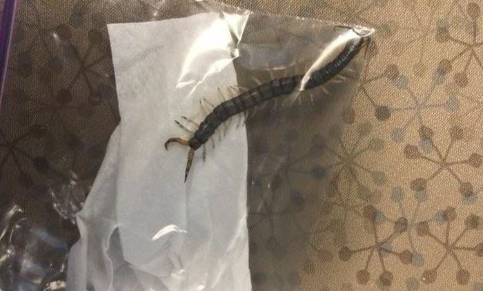 Teenager Pulls 4 Inch Centipede Out Of His Own Ear (3 pics)