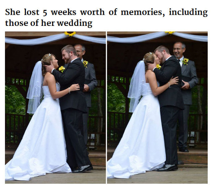 Husband Sets Up Second Wedding After Wife Loses Her Memory In A Car Crash (8 pics)
