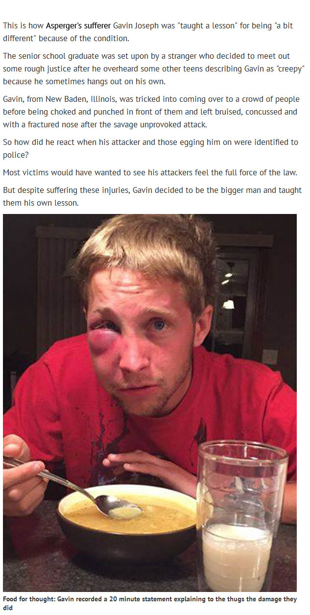 Kids Beat Up This Teen With Aspergers Find Out Why He Didn't Press Charges (4 pics)