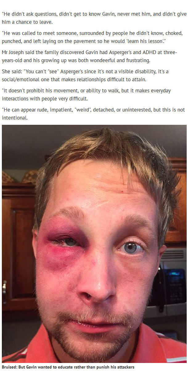 Kids Beat Up This Teen With Aspergers Find Out Why He Didn't Press Charges (4 pics)