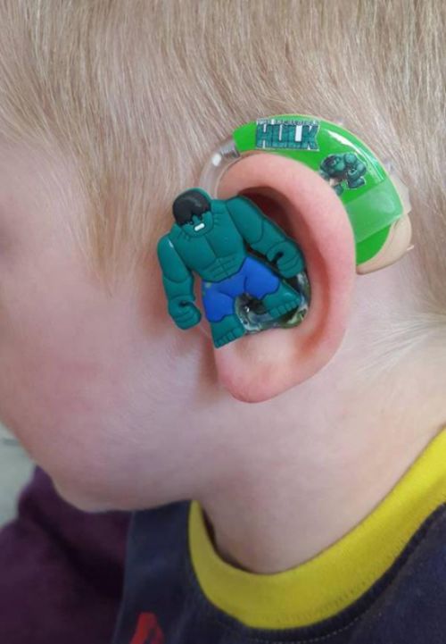 This Mom Created The Coolest Hearing Aids Ever For Her Hearing Impaired Son (8 pics)