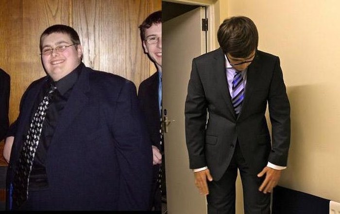 The Unseen Downside To Losing 260 Pounds In Three Years (7 pics)