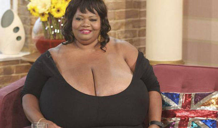 Strange But True Medical Issues Humans Have Had With Their Sexual Organs (10 pics)