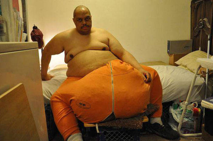 Strange But True Medical Issues Humans Have Had With Their Sexual Organs (10 pics)
