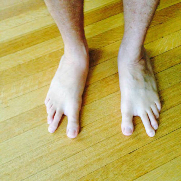 Acid Picdump (116 pics)