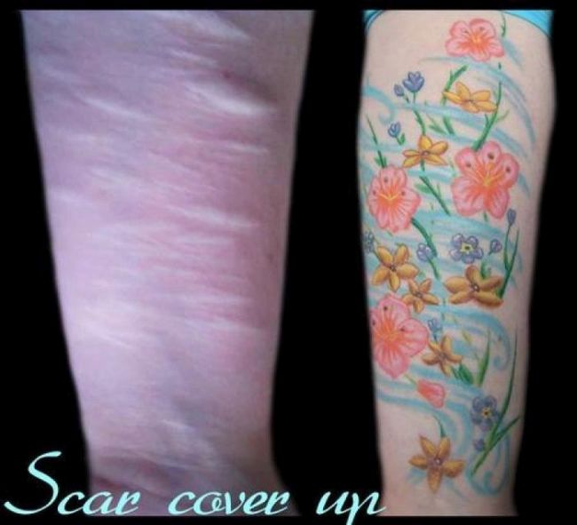 How To Hide Scars (15 pics)