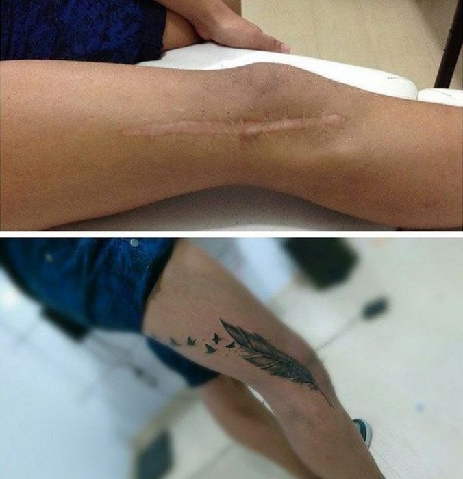 How To Hide Scars (15 pics)